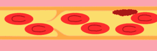 ʲôL